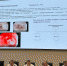 Выступление онкологов на конференции БУЗ ВО ВОКОД - Медицинский Университет им. Н.Н. Бурденко