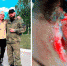 Воронежец головой отбил дрон-камикадзе - Bloknot-Voronezh.Ru