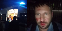 Воронежский наблюдатель заявил об избиении возле избирательного участка - TV-Gubernia.Ru