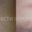 Воронежские врачи рассказали о состоянии избитого в школе четвероклассника - ГТРК Воронеж