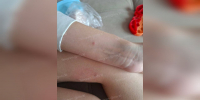 В Воронеже бездомная собака напала на девочку - ГТРК Воронеж