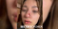 Избитую бывшим девушку в Воронеже обвинили в провокациях - ГТРК Воронеж