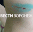 В мэрии прокомментировали нападение стаи собак на женщину в центре Воронежа - ГТРК Воронеж