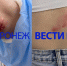 Стая из семи собак искусала девушку на проспекте Патриотов в Воронеже - ГТРК Воронеж