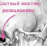 Хирурги спасли воронежанку, страдавшую 15 лет от адских болей - МОЁ! Online