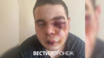 Полиция начала проверку после избиения парня профессиональным боксёром в Борисоглебске