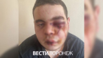 Полиция начала проверку после избиения парня профессиональным боксёром в Борисоглебске