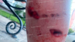 В Воронеже не смогли поймать напавших на девушек собак на Олимпийском бульваре