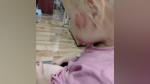 В Воронежской области в дошкольной группе 3-летний мальчик во время тихого часа искусал девочку
