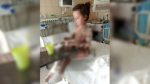 У 7-летней девочки отслоилась кожа после лечения в воронежской клинике